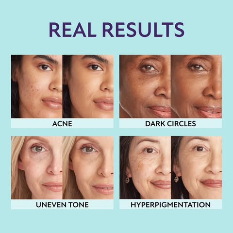 Radiant Skin Magic Cream